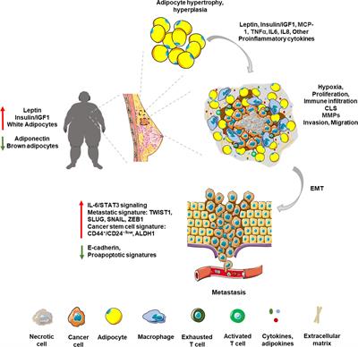 Obesity, dysbiosis and inflammation: interactions that modulate the efficacy of immunotherapy